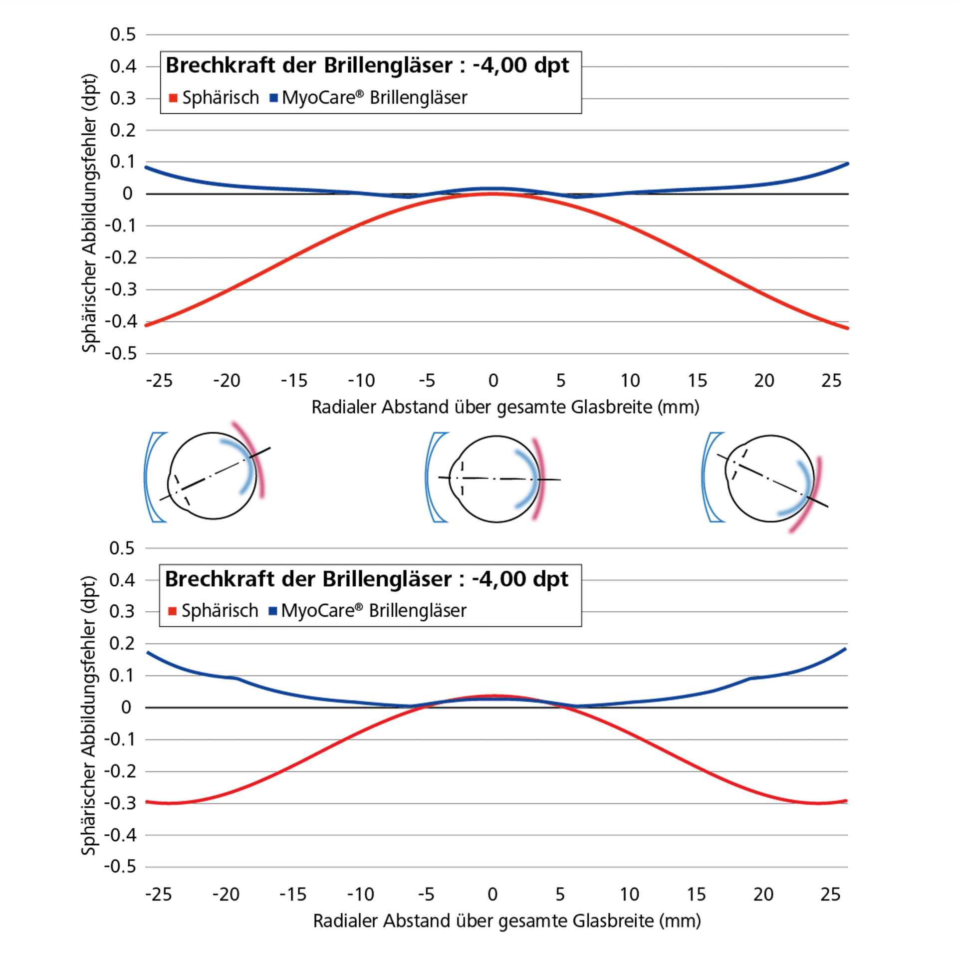 Zwei Liniendiagramme, die den Unterschied von sphärischen Einstärkengläsern (in rot) und MyoCare-Linsen (in blau) zeigen.